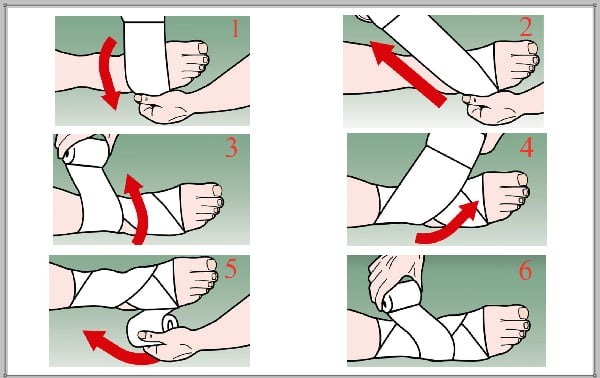băng cuốn thể thao Zocker 1
