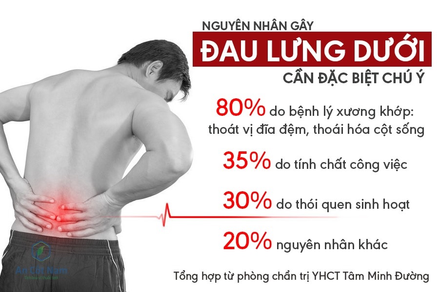 Một số nguyên nhân chủ yếu gây đau lưng